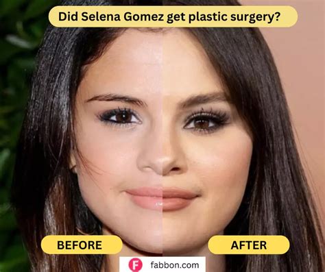 when did selena gomez boobs get so big|The Truth About Selena Gomezs Plastic Surgery Rumors